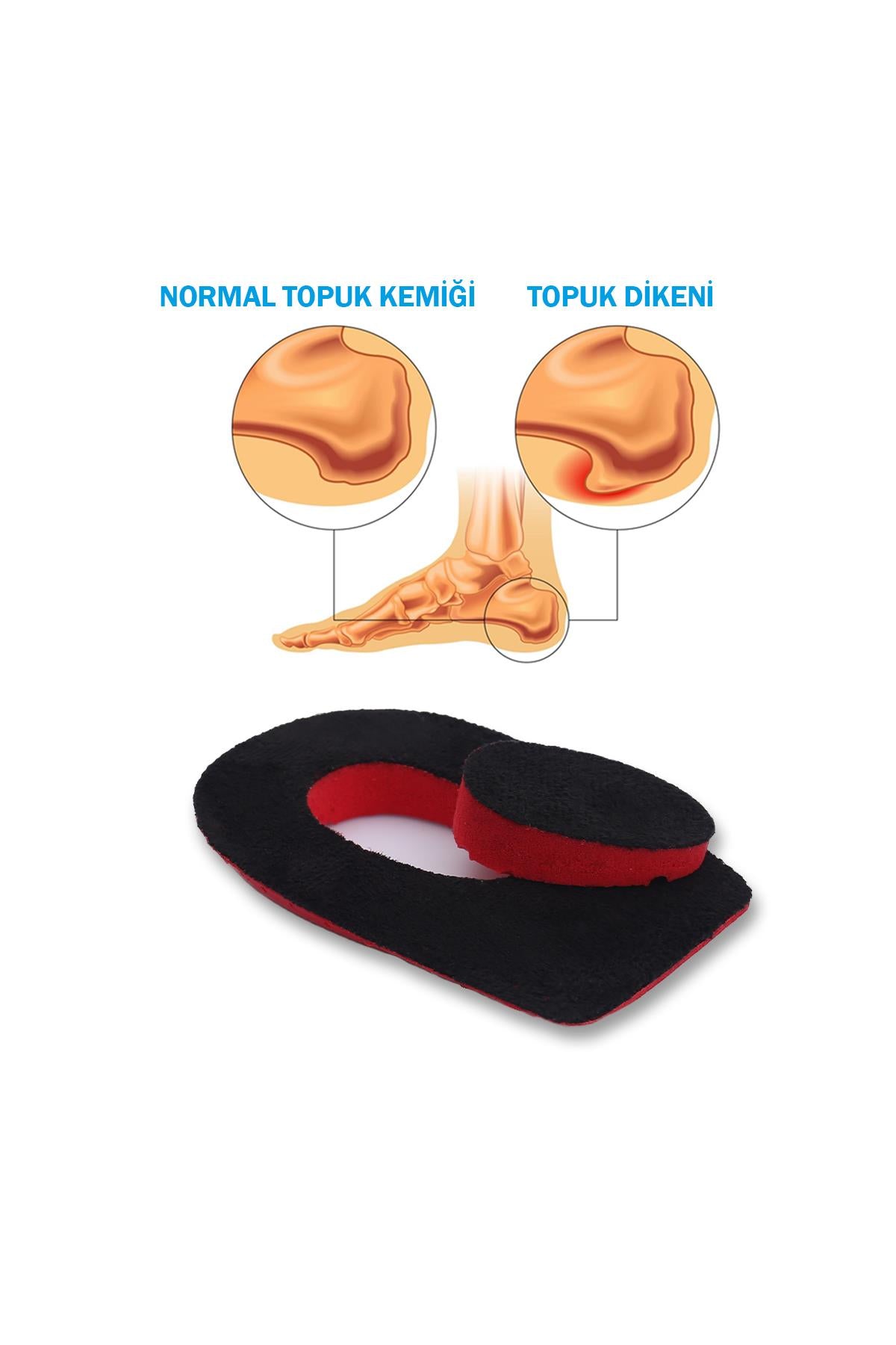 Heelspur topuk dikeni tabanlığı siyah kırmızı yakın çekim